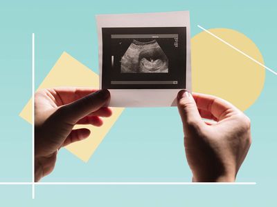 Hands with an ultrasound picture