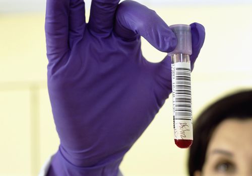 病理学家戴着橡胶手套拿着血样的特写