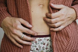 展示腹部剖腹产疤痕的女人