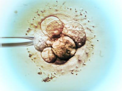 Embryo selection for IVF light micrograph