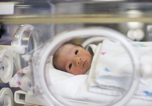 NICU婴儿