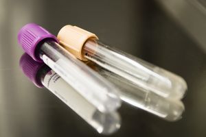 两个试管用于克罗米德挑战试验