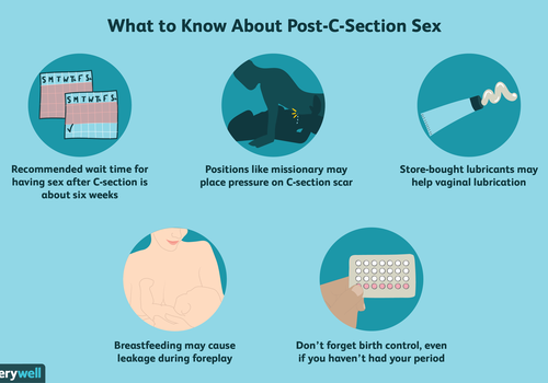 Post-C-Section性