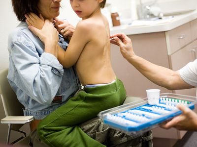 child getting a skin prick test