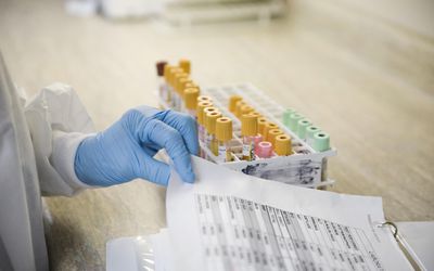 实验室技术员带着血样和病历