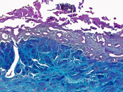 Cross section of endometrium, Uterus, Day 28, menses, micrograph 20x