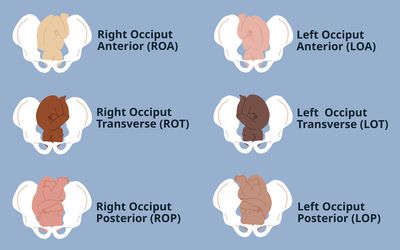 An illustration with fetal positions for labor and birth