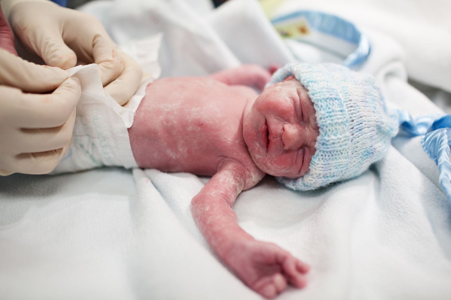 Newborn baby with a hat, covered in a layer of vernix