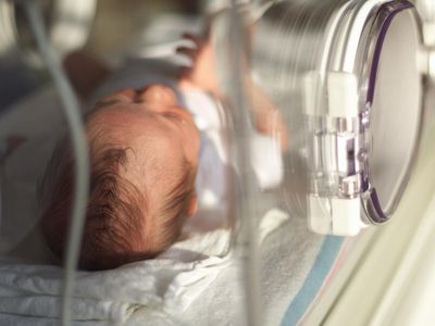 A premature baby in an incubator