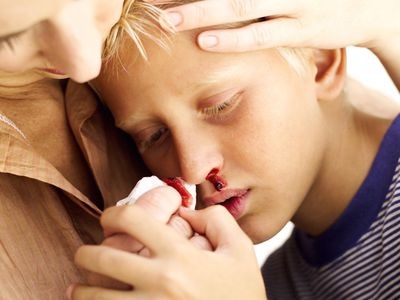 Mother tending to her son's nosebleed