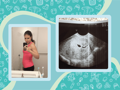 Elizabeth Narins' ultrasound