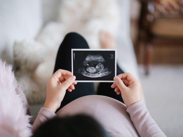 Pregnant woman holding an ultrasound of her fetus