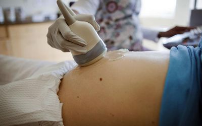 一位孕妇正在做腹部超声波检查