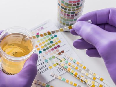 urine test