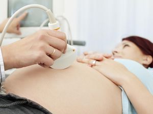 孕妇怀孕了