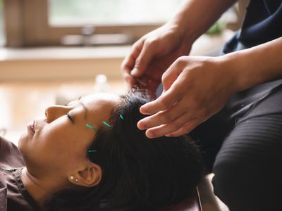Woman at the acupuncturist