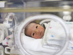 NICU婴儿