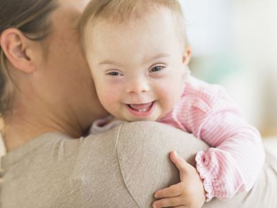 Mother holding baby girl with Down syndrome