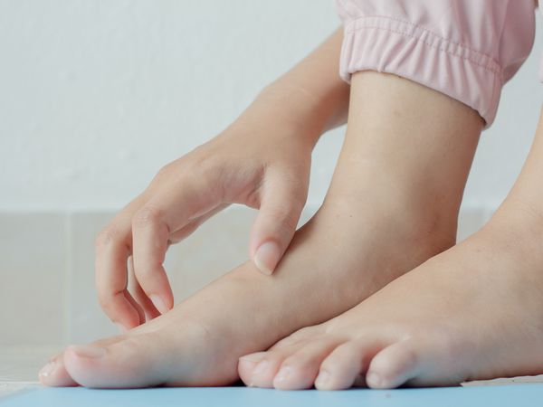 itchy feet
